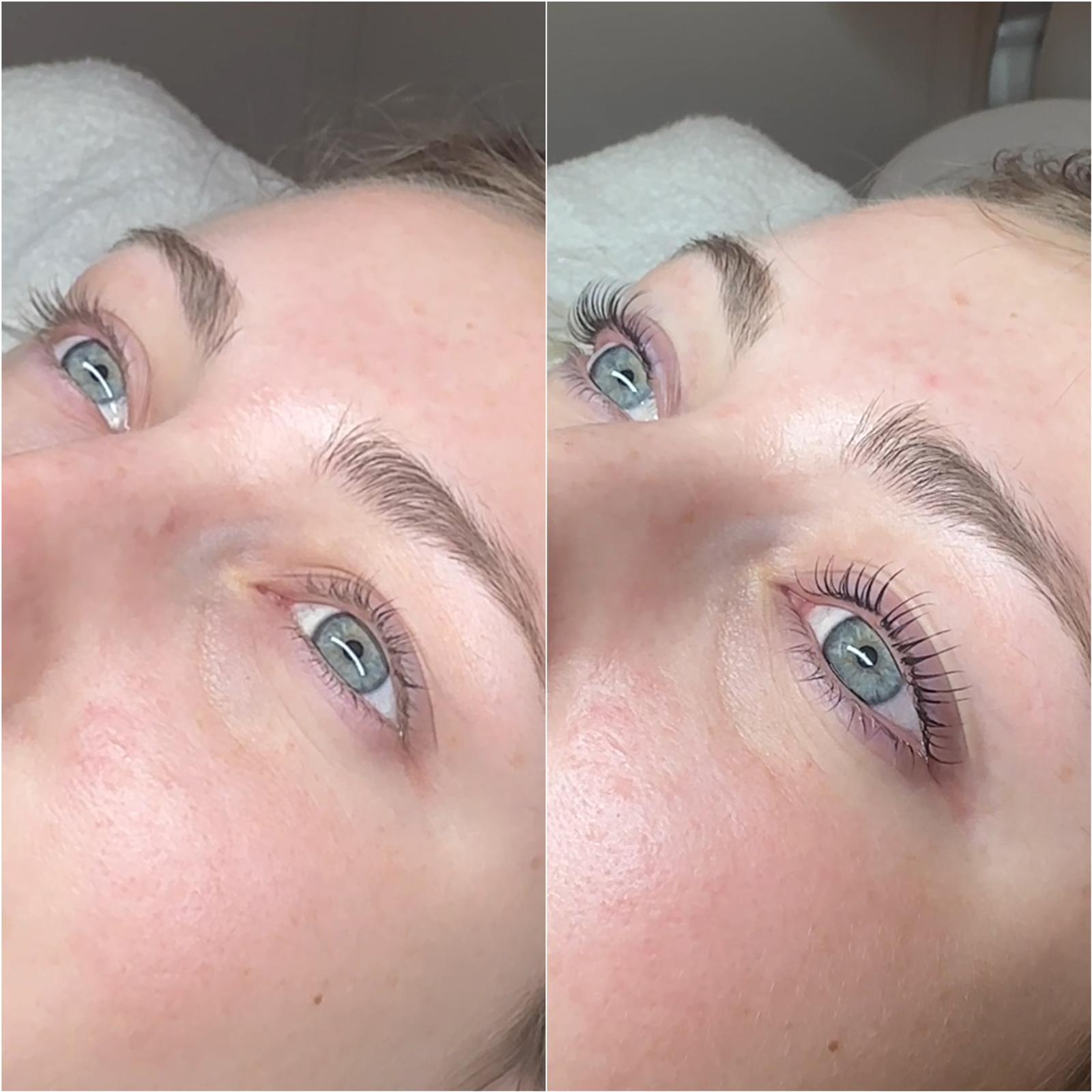 vihanje trepanic menjaj zaradi kvalitete